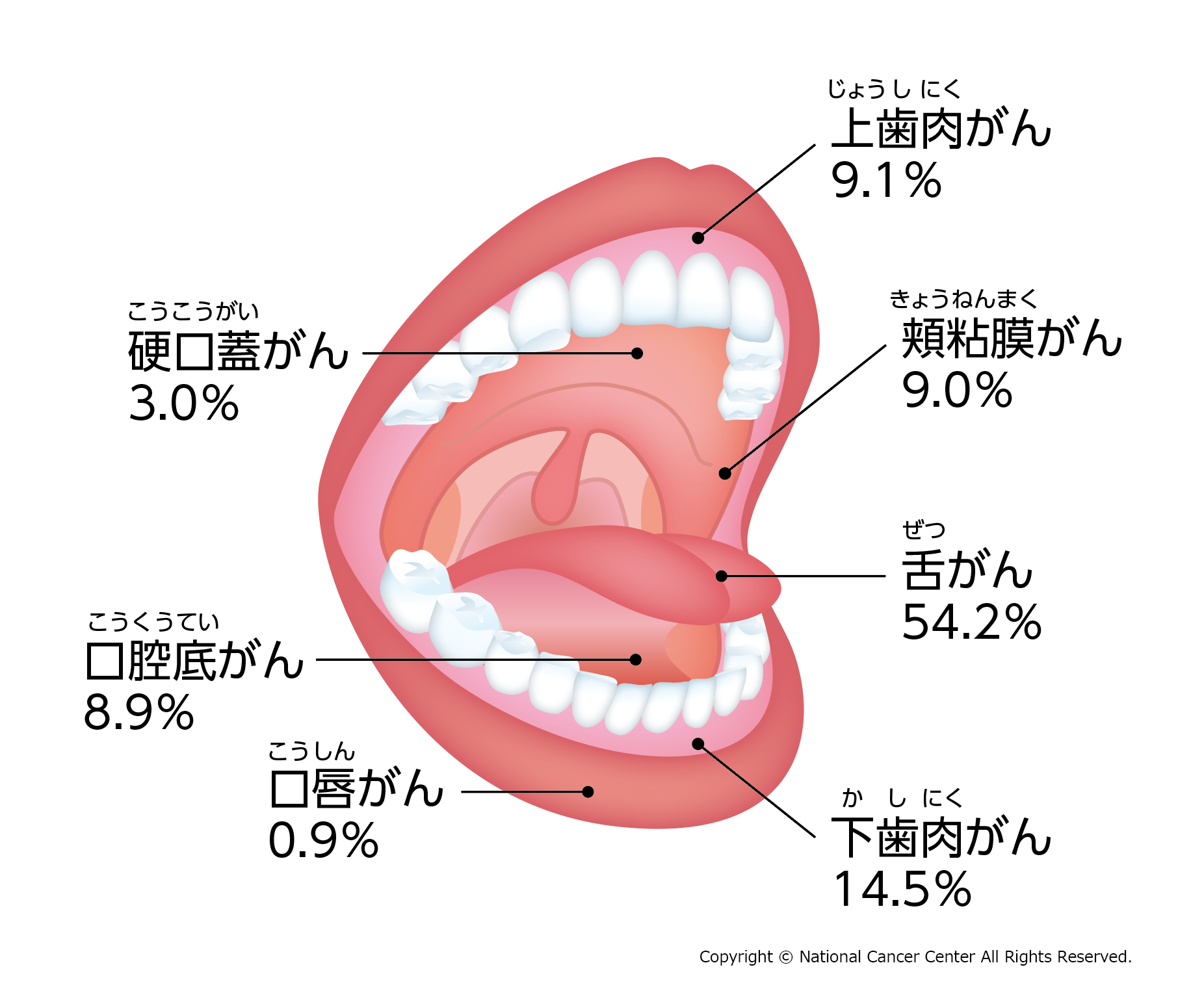 口腔がんの割合の図